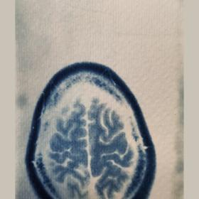 ‘Vallend Brein’, 16,5 × 8 cm, cyanotypie